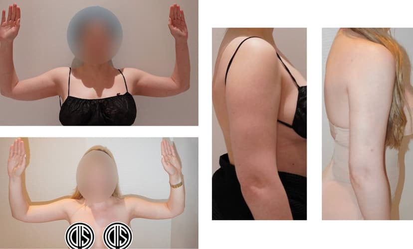 Before and after