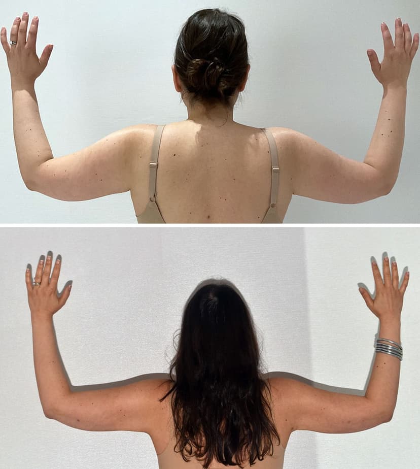 Before and after