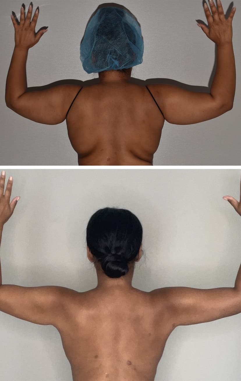 Before and after