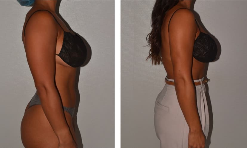 Before and after