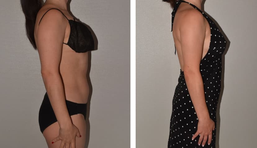 Before and after