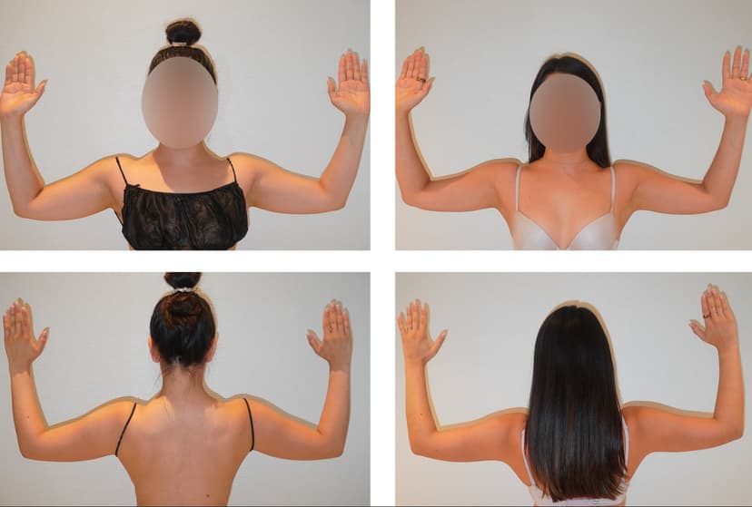 Before and after