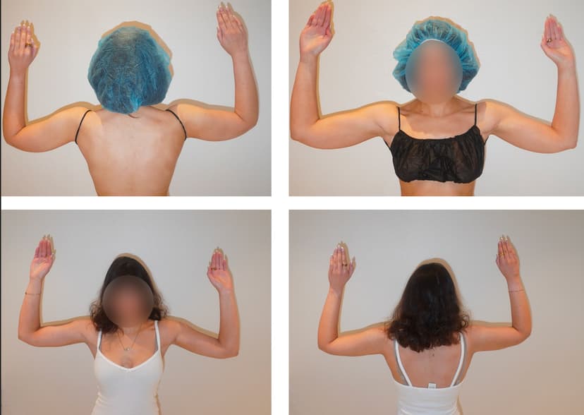 Before and after