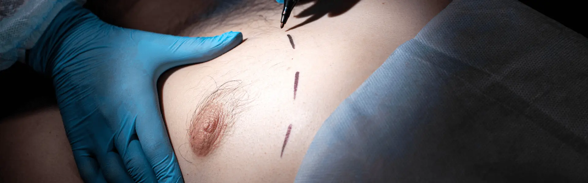 A woman with a needle on her tummy.