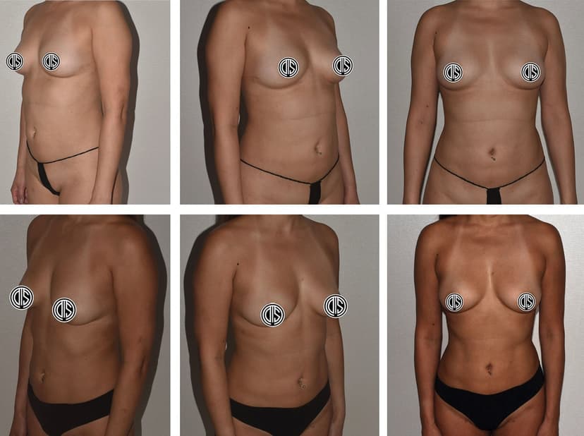 Before and after