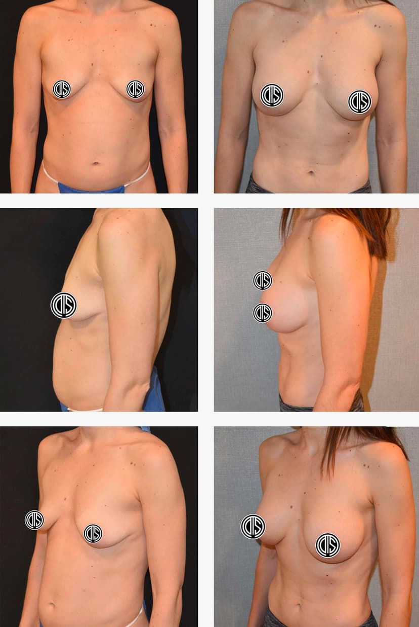 Before and after