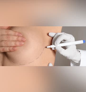 Implant Revision