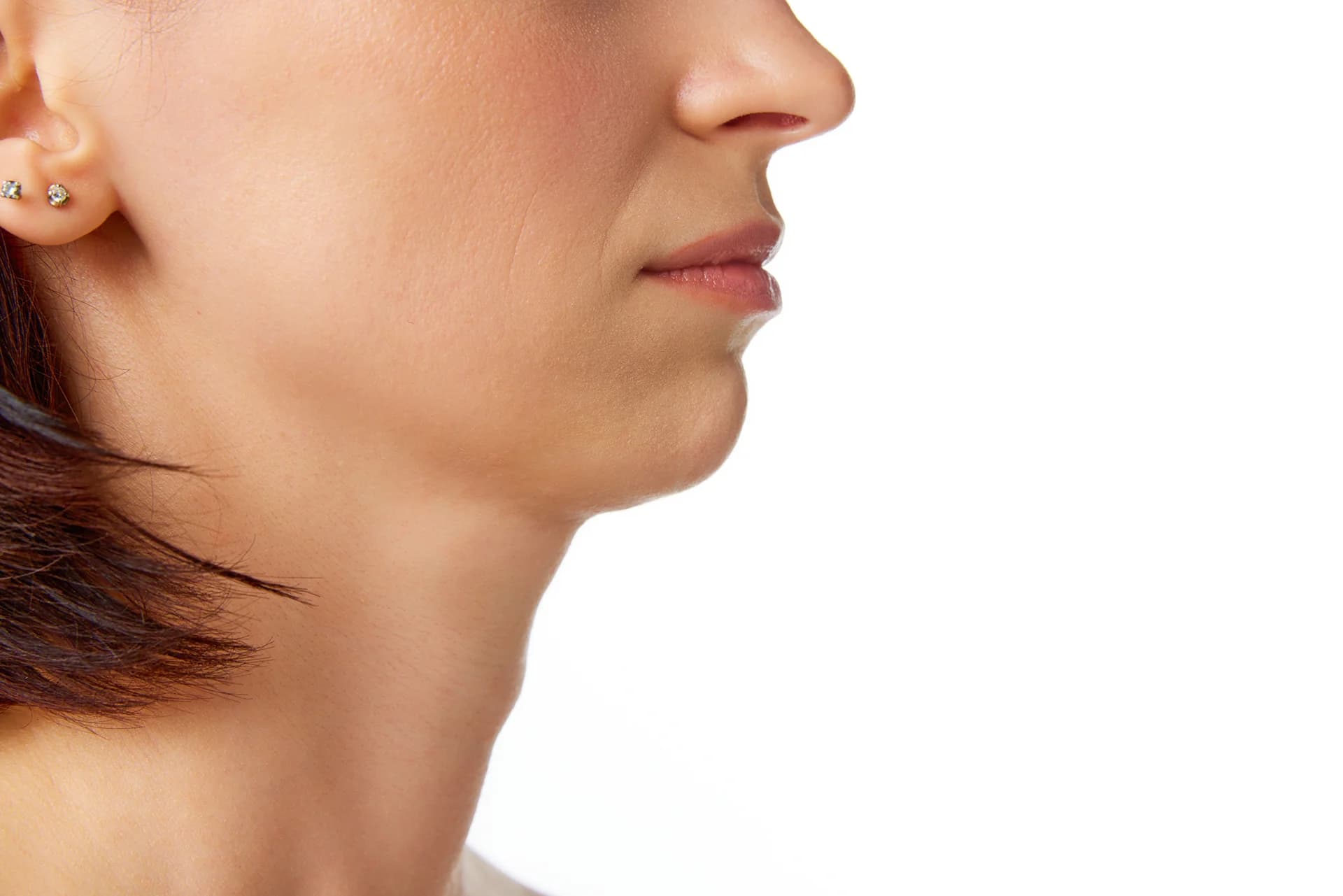 chin liposuction treatment