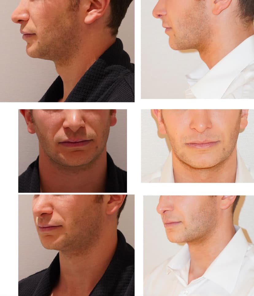 Before and after