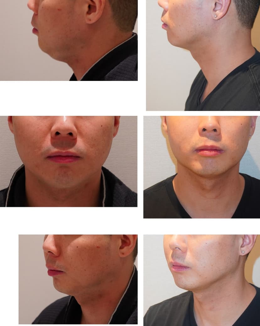 Before and after