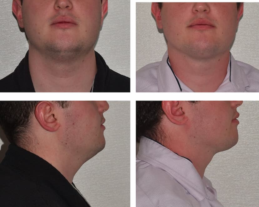 Before and after