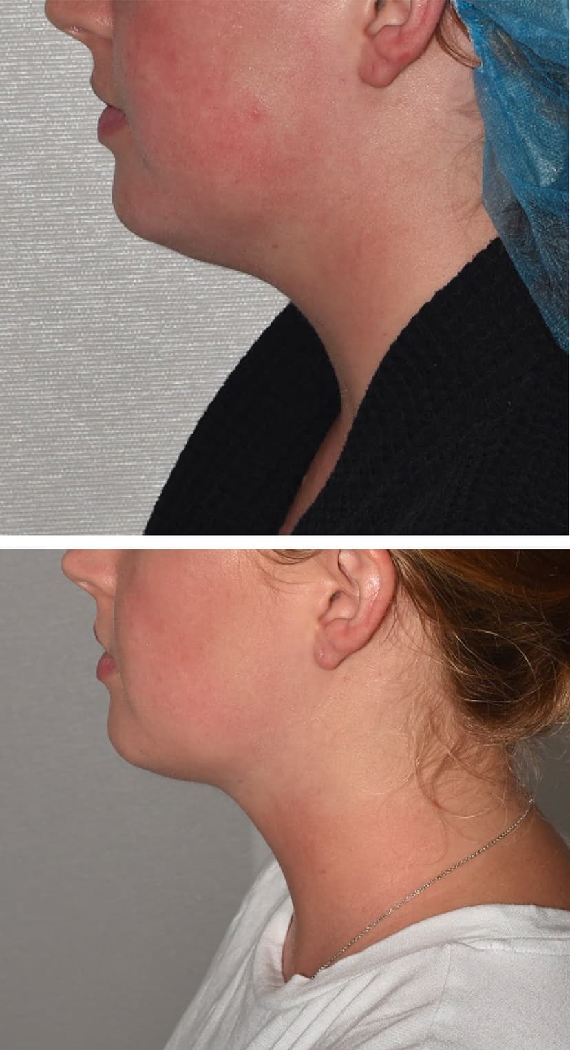 Before and after