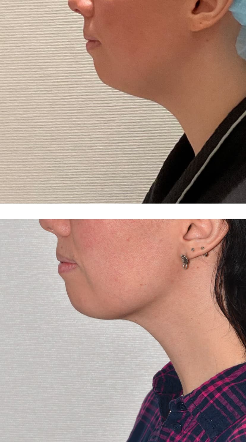 Before and after