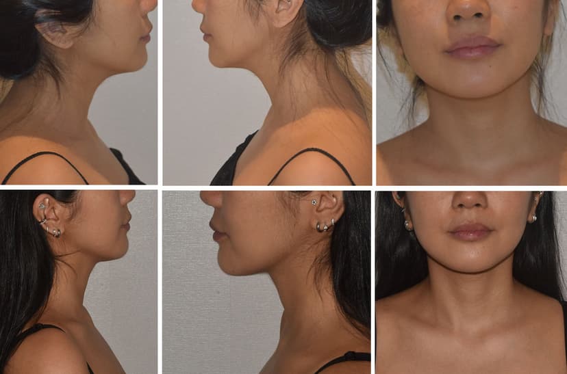 Before and after