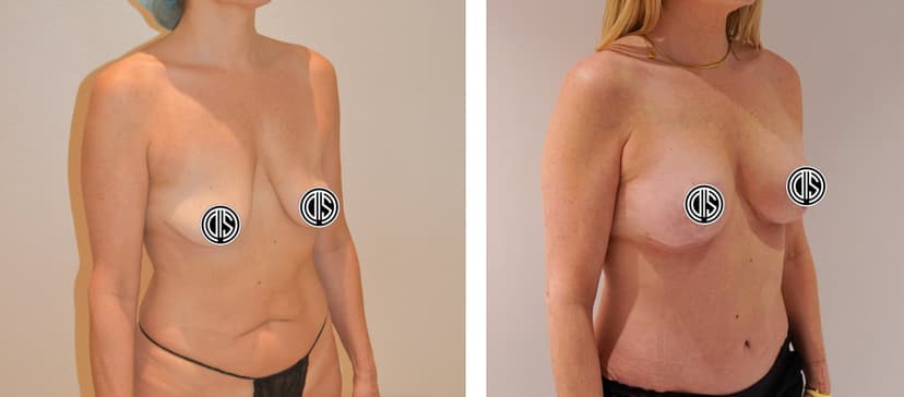 Before and after