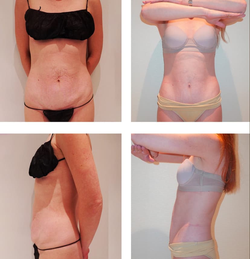 Before and after