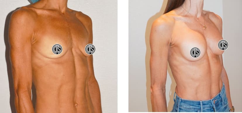 Before and after