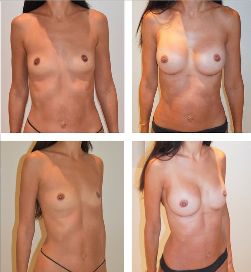 Before and after