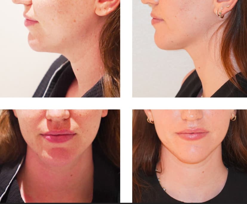 Before and after