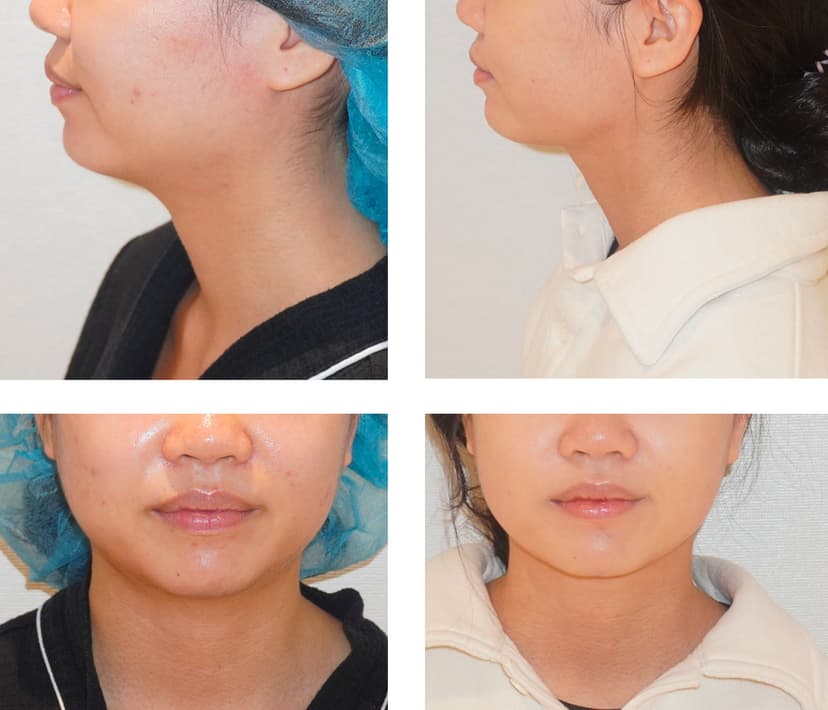 Before and after