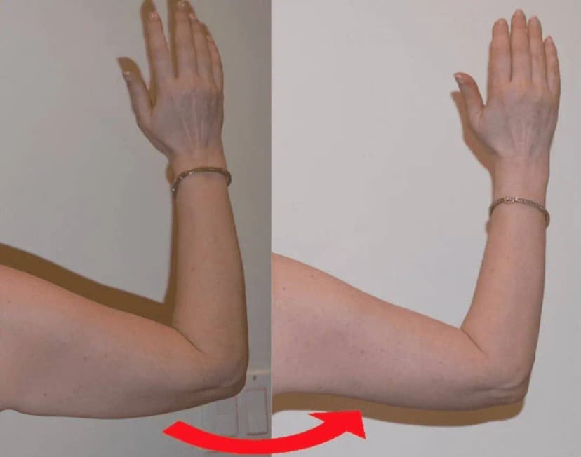 Before and after
