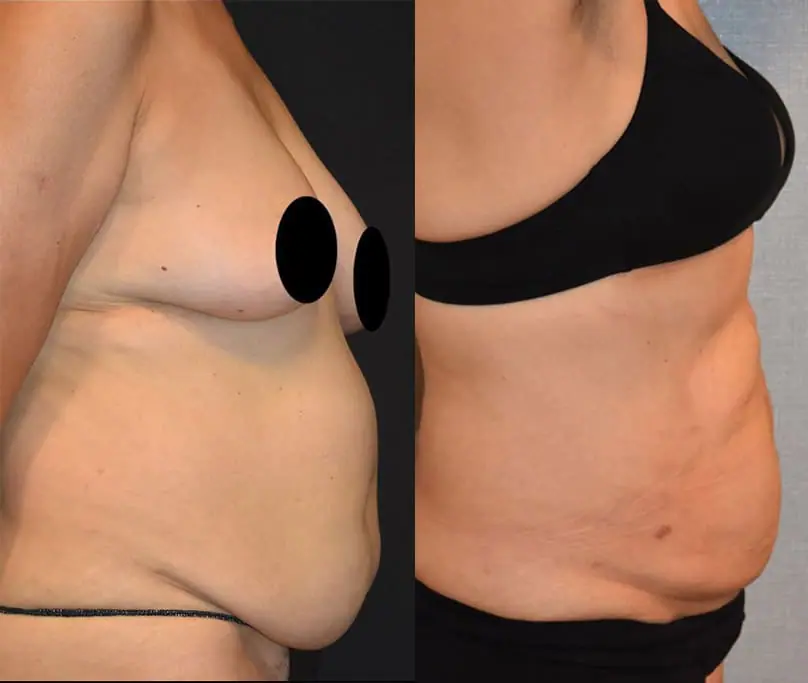 Before and after
