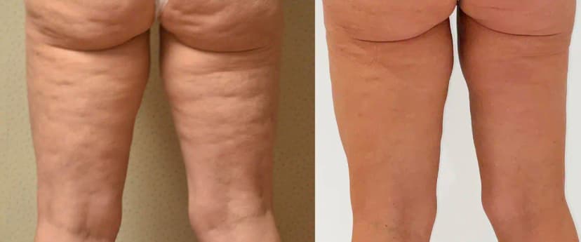 Before and after
