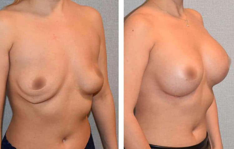 Gallery photo 1