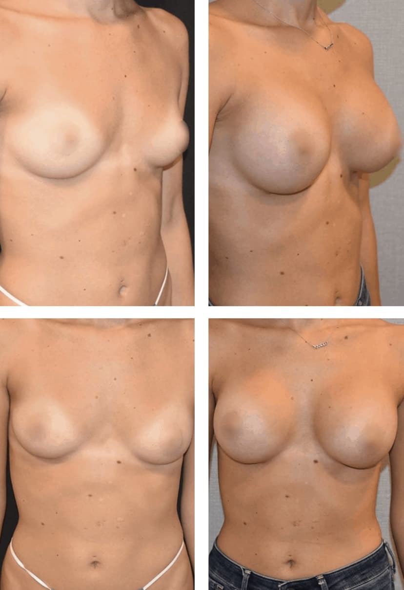 Before and after