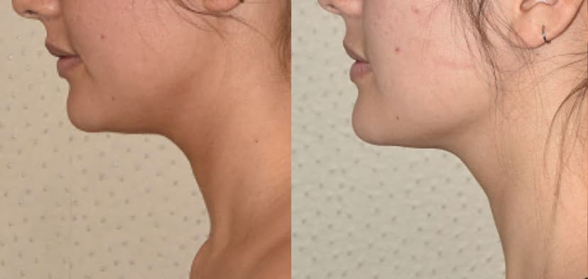 Before and after