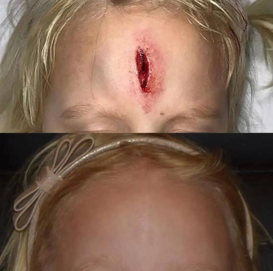 Facial Surgery Before & After Patient 3