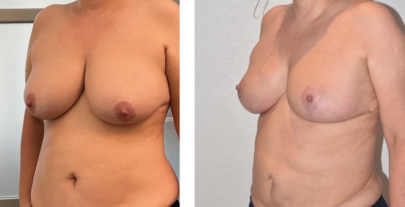 Before and after