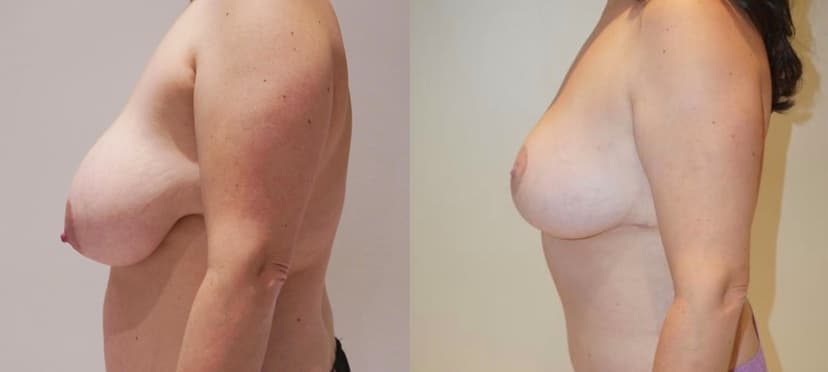 Before and after