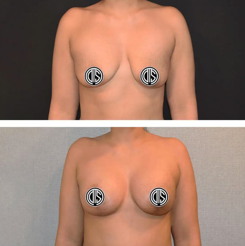 Before and after