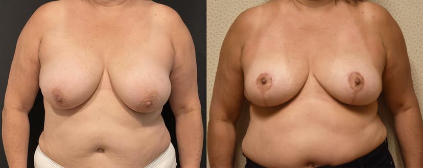 Before and after