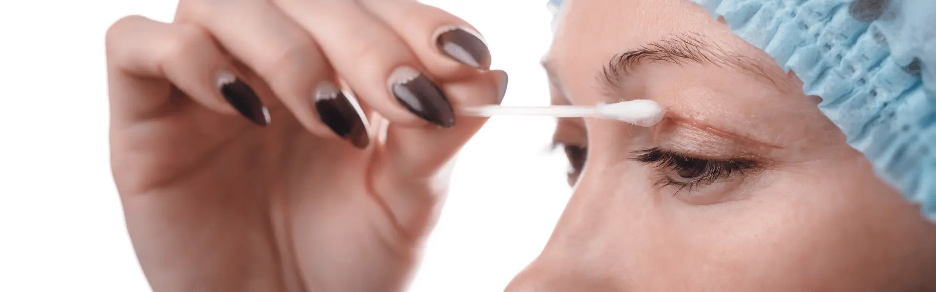 Eyelid Surgery