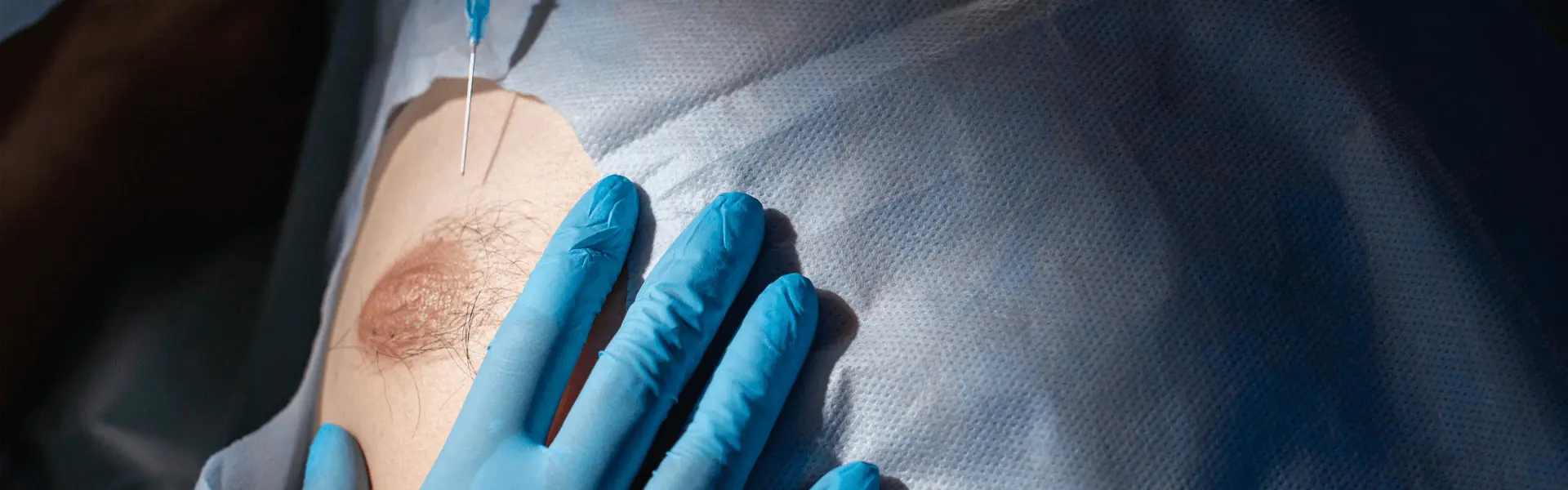 A surgeon is holding a woman's breast in blue gloves.