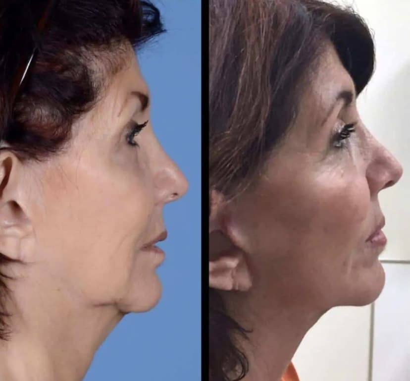 Before and after