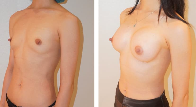 Before and after