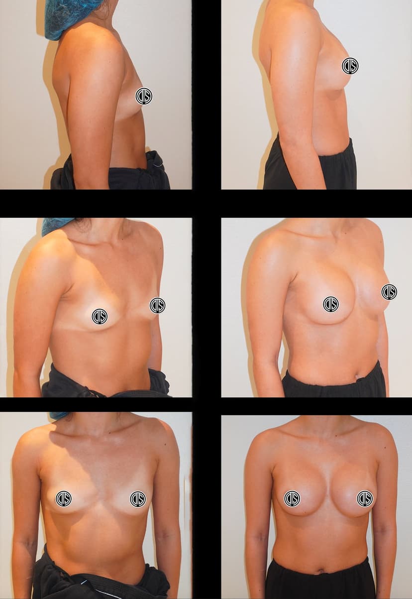 Before and after