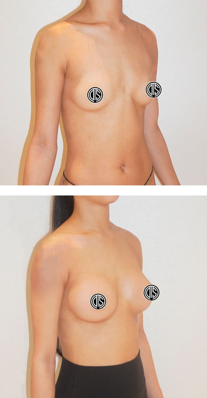 Before and after