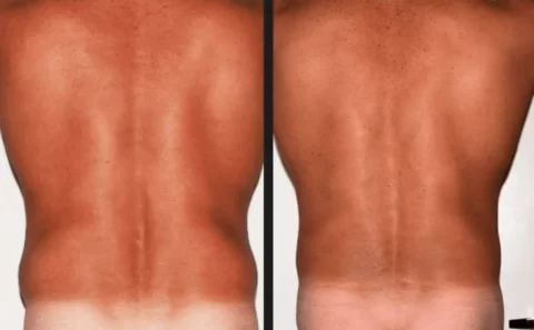 A man's back before and after getting a tan showcasing the transformative effects of sun-kissed skin.