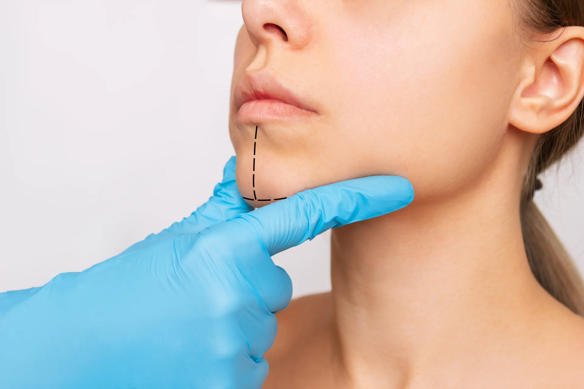 A woman's face undergoes a needle piercing during chin liposuction, highlighting the importance of taking appropriate steps and avoiding mishaps.