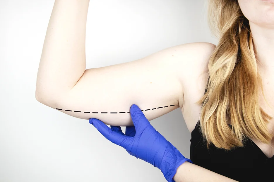 A woman with a blue glove holding an arm with an arrow on it, showcasing confidence and the results of arm liposuction.