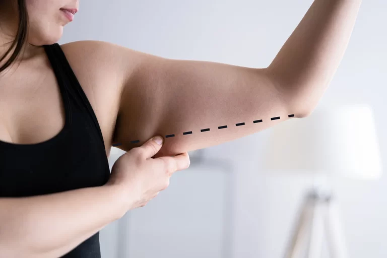 A woman is measuring her arm to ensure fabulous arms are achieved through brachioplasty.