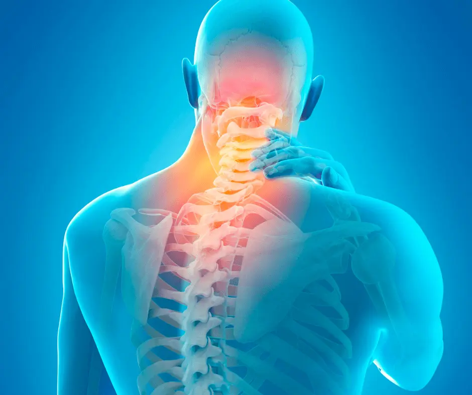 3D image of a man with a neck pain caused by a Buffalo Hump.