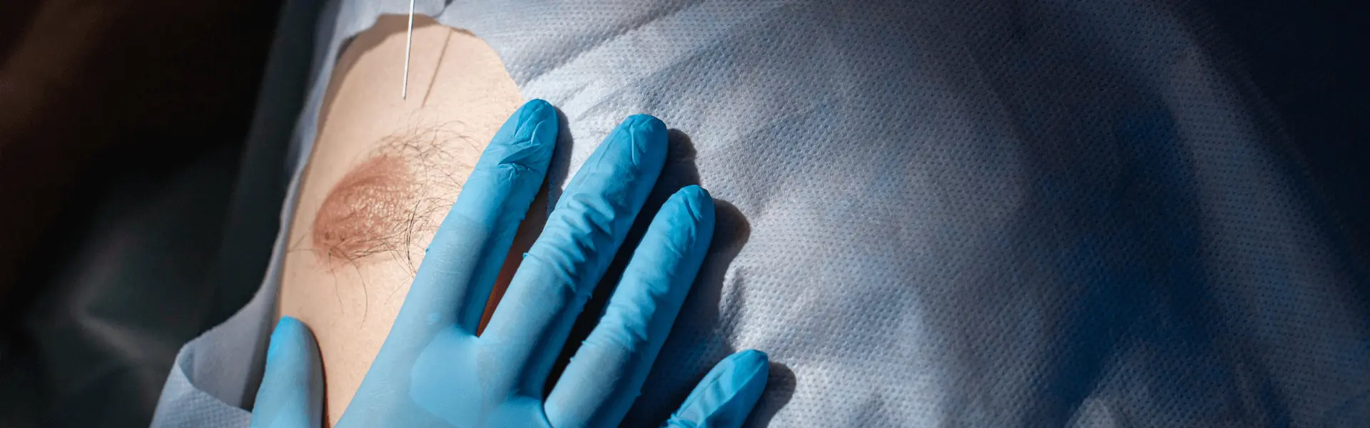 A surgeon is holding a woman's breast in blue gloves.