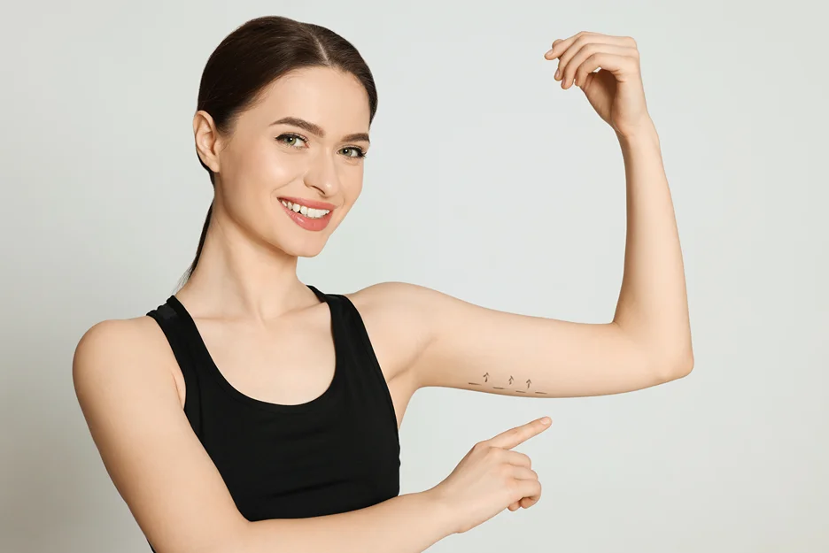 A woman proudly displaying her sleek arms, adorned with a marks for arm lipo procedure.