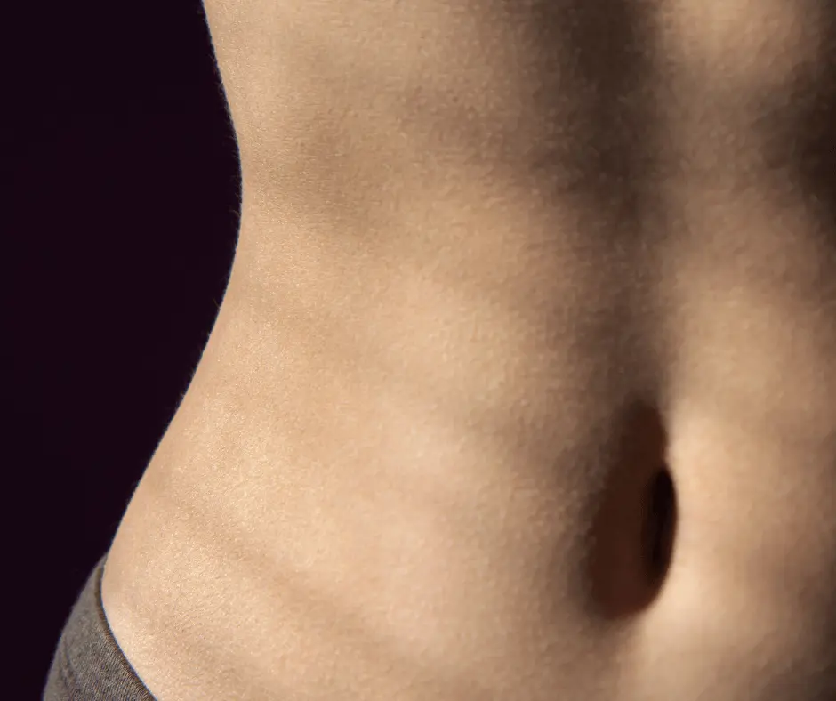 A close up of a woman's stomach displaying signs of PCOS.