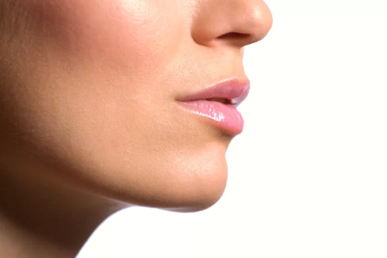 A close up of a woman undergoing Chin Lipo Recovery.